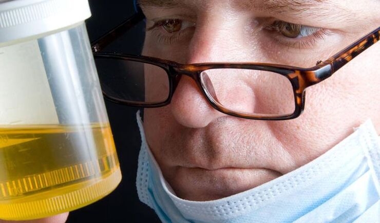 Analisi delle urine per prostatite cronica